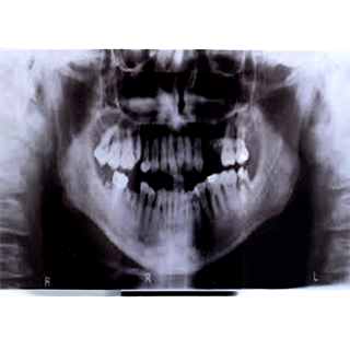 Ilustración sobre Violencia física